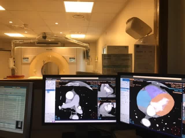 IRM Cardiaque et Scanner Coronaire - ICPS 
