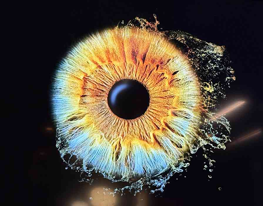 Emma Redon, Orthoptiste à Sainte-Sigolène