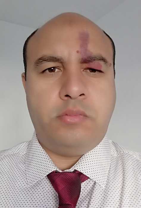 Dr BOUSSAIRI MOTTAKEL