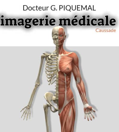 Centre D'imagerie Médicale De Caussade, Radiologue à Caussade