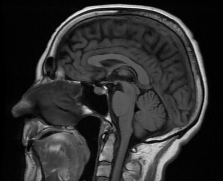 Dr Guillaume BRETON, Radiologue à FREJUS, ST RAPHAEL, STE MAXIME, DRAGUIGNAN, Fréjus, Sainte