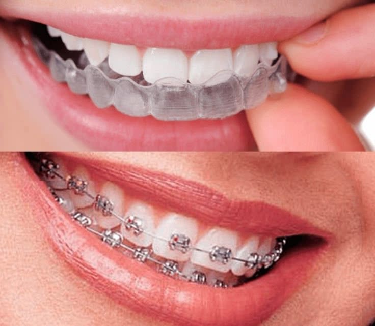 Dr Elena Devos, Chirurgien dentiste à Lannoy