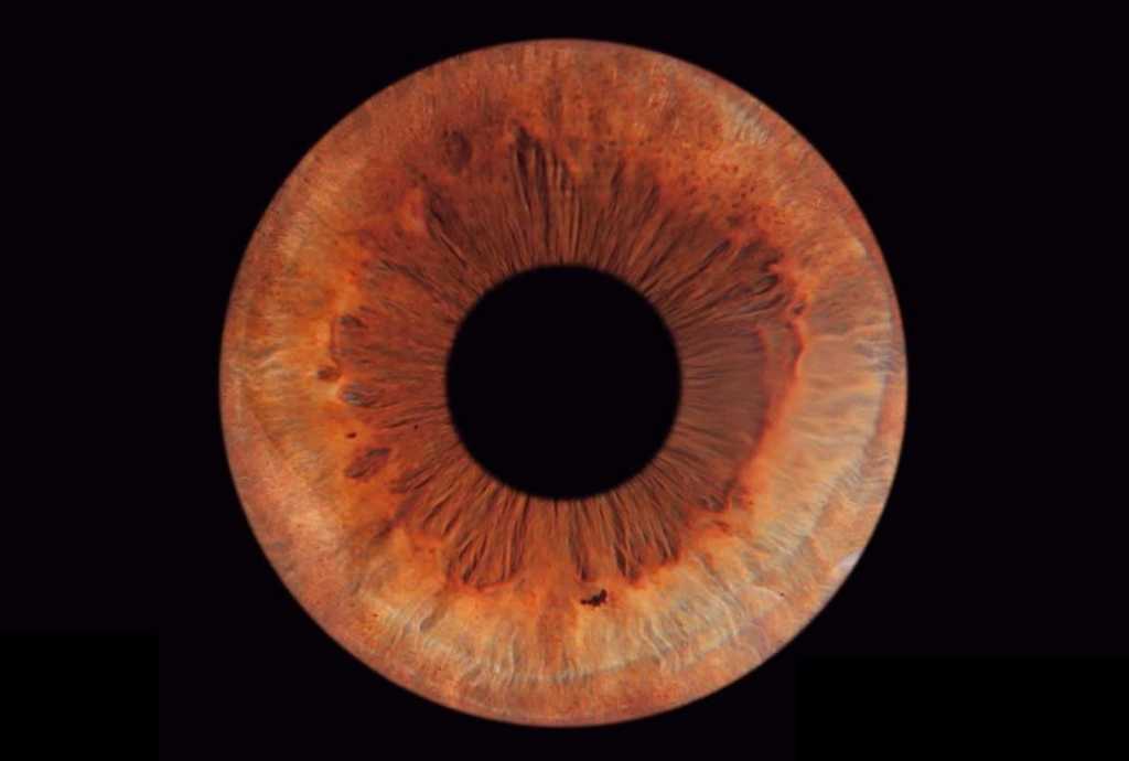 Orthoptiste Du Barry, Orthoptiste à Muret