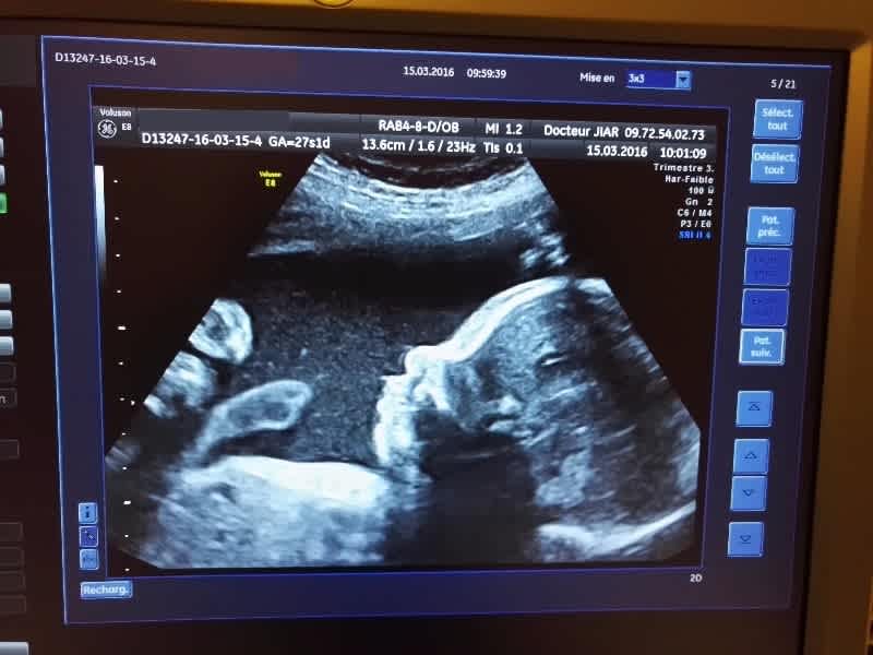 Dr Nassera Jiar Echographiste A Villepinte Prenez Rdv En Ligne