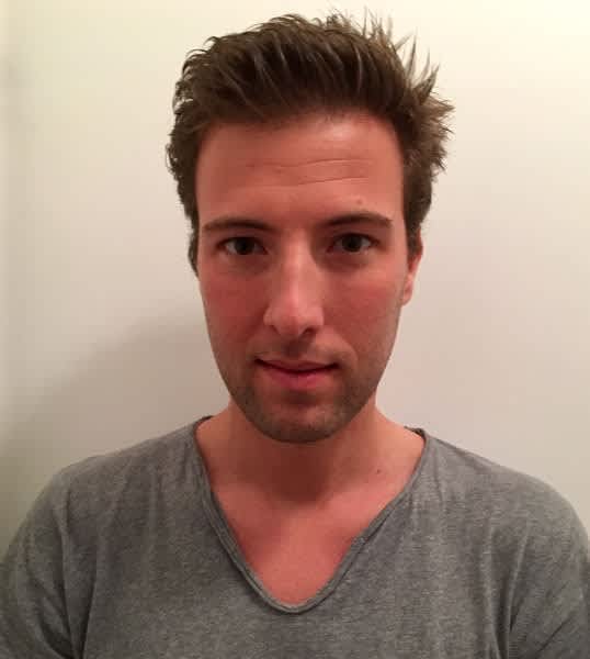 Axel  ZANCHET 